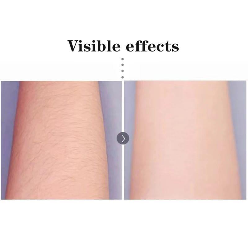 DL-6015 Rechargeable Hair Epilator